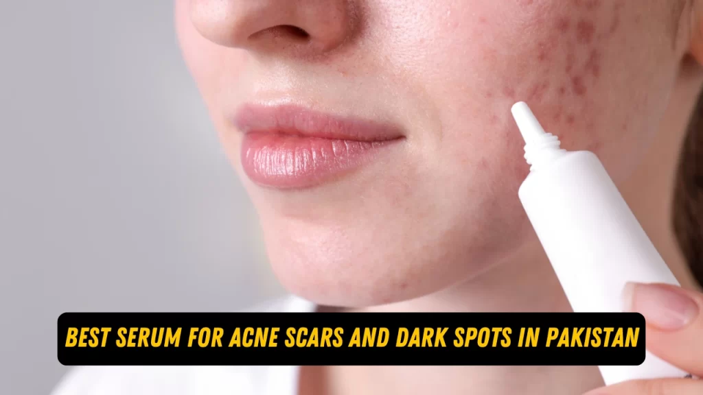 best serum for acne scars and dark spots in Pakistan